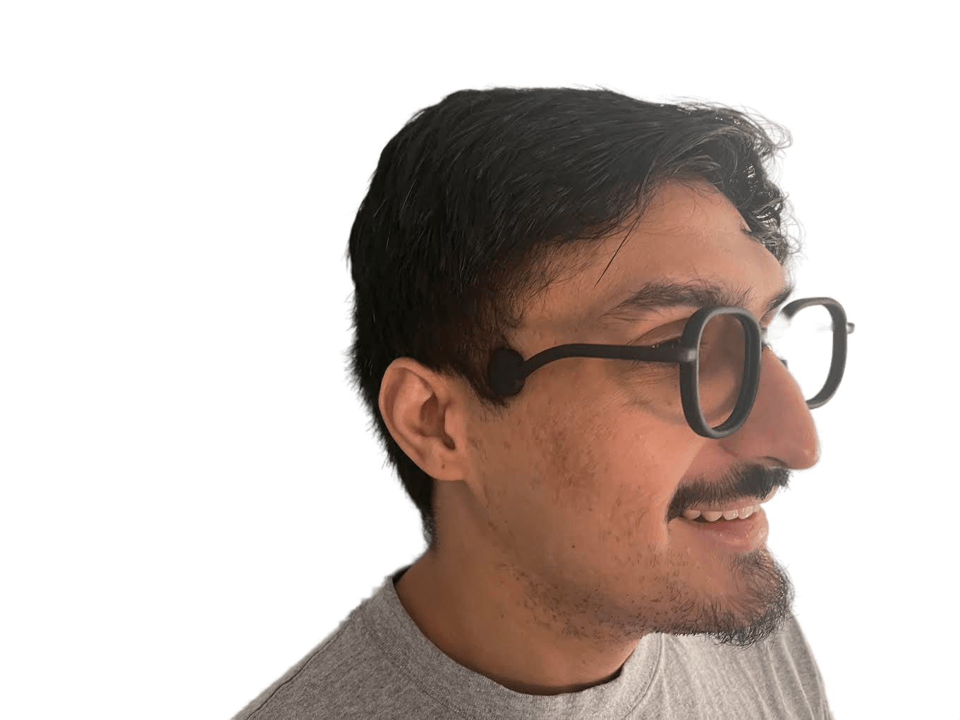 Real wearer of Jaybs patented spectacles — temple-mounted disc pad detail